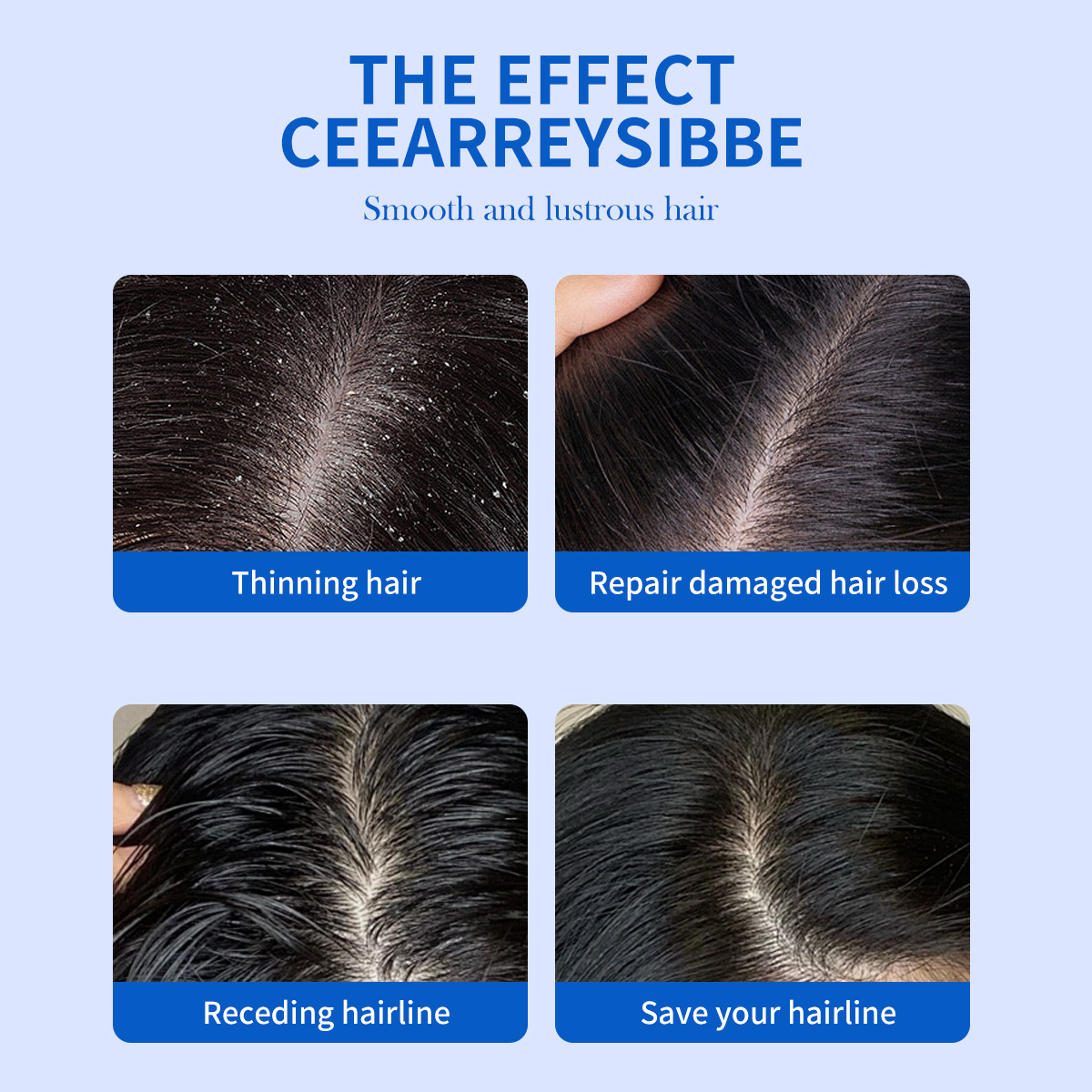 325ml セレン二硫化物配合 ふけ防止シャンプー 保湿ケア - Hair Care Dandruff のレビューと価格